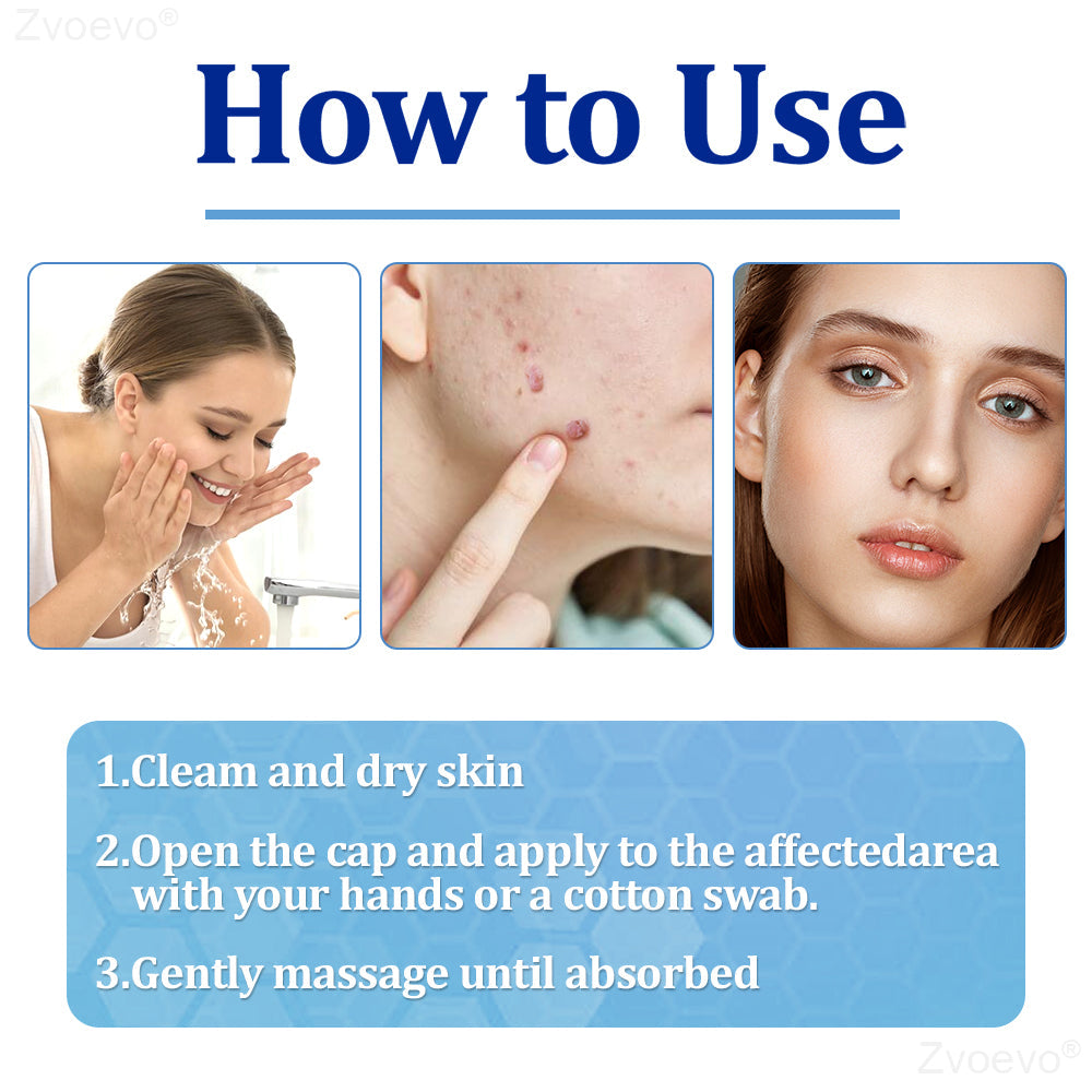 🔥 Zvoevo® BeeDerm RX Cream | Gentle Targeted Care for Warts, Skin Tags, Bumps, Infections, Cysts and Scars