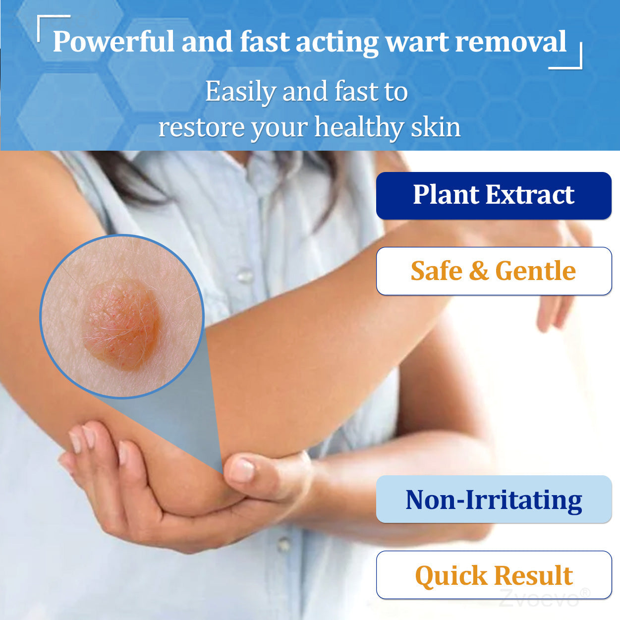 💝Zvoevo® BeeDerm RX Solution | Gentle, Targeted Care for Warts, Skin Tags, Skin Lesions, Infections, Cysts and Scars