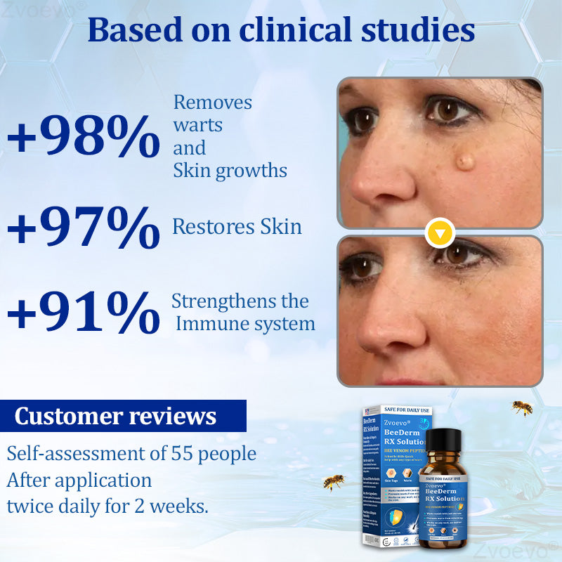 💝Zvoevo® BeeDerm RX Solution | Gentle, Targeted Care for Warts, Skin Tags, Skin Lesions, Infections, Cysts and Scars
