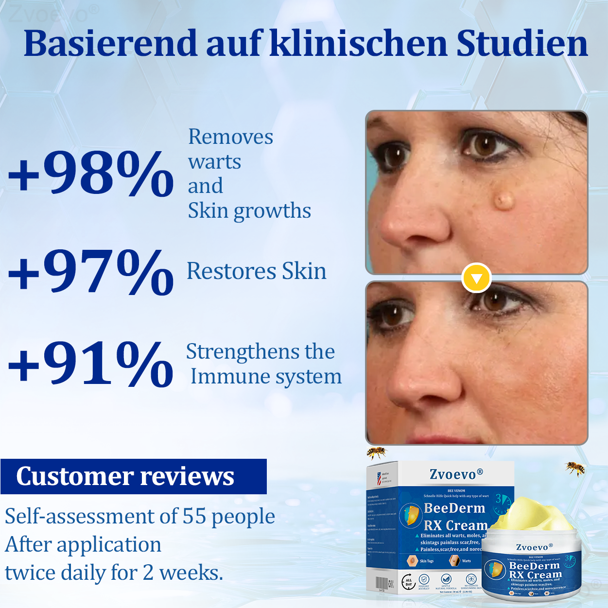 🔥 Zvoevo® BeeDerm RX Cream | Gentle Targeted Care for Warts, Skin Tags, Bumps, Infections, Cysts and Scars