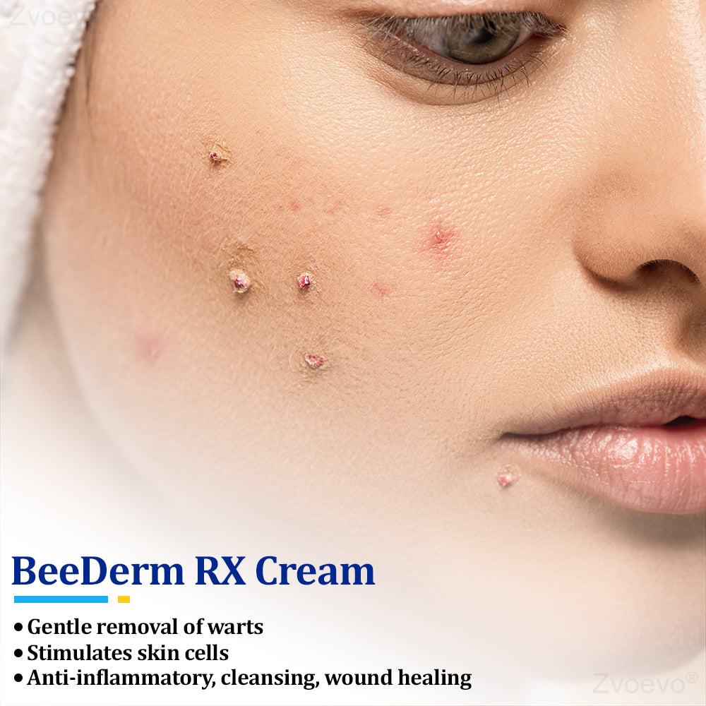 🔥 Zvoevo® BeeDerm RX Cream | Gentle Targeted Care for Warts, Skin Tags, Bumps, Infections, Cysts and Scars