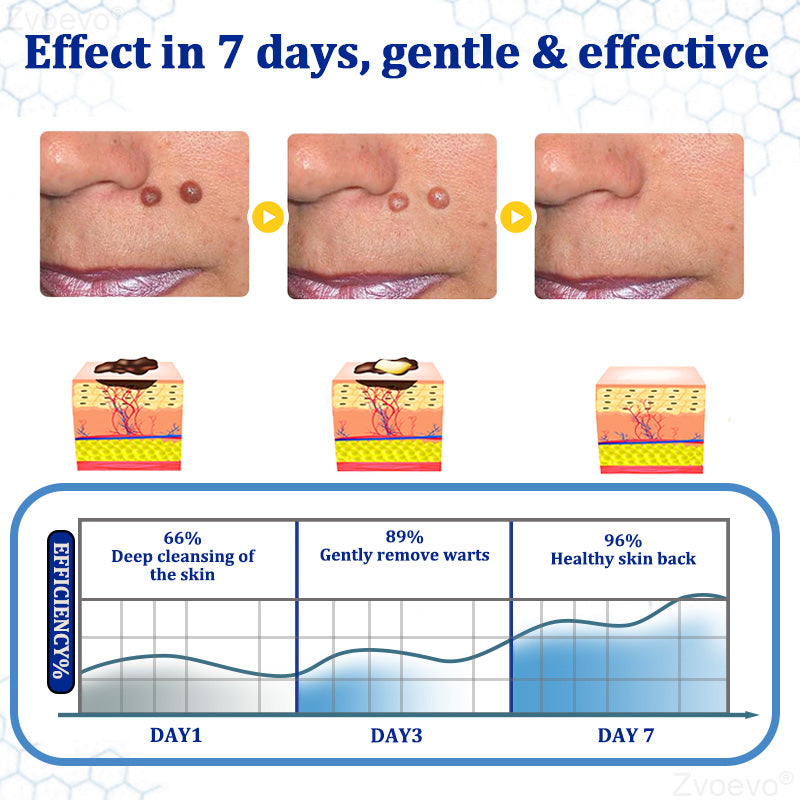 🔥 Zvoevo® BeeDerm RX Cream | Gentle Targeted Care for Warts, Skin Tags, Bumps, Infections, Cysts and Scars