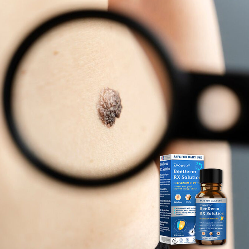 💝Zvoevo® BeeDerm RX Solution | Gentle, Targeted Care for Warts, Skin Tags, Skin Lesions, Infections, Cysts and Scars