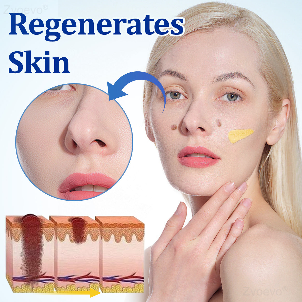 💝Zvoevo® BeeDerm RX Solution | Gentle, Targeted Care for Warts, Skin Tags, Skin Lesions, Infections, Cysts and Scars