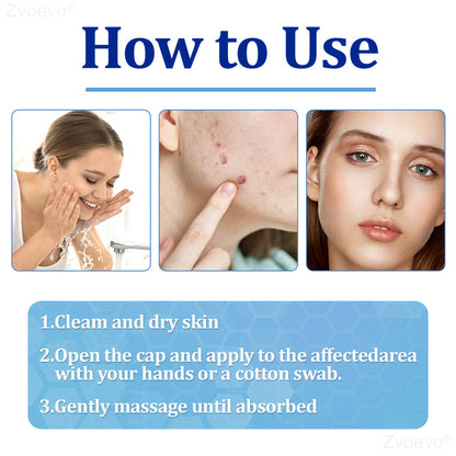🔥 Zvoevo® BeeDerm RX Cream | Gentle Targeted Care for Warts, Skin Tags, Bumps, Infections, Cysts and Scars