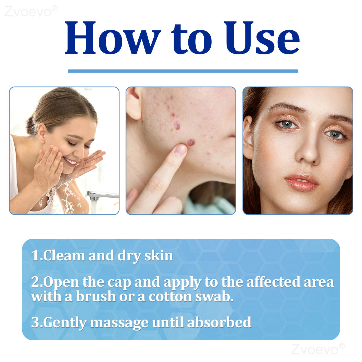 💝Zvoevo® BeeDerm RX Solution | Gentle, Targeted Care for Warts, Skin Tags, Skin Lesions, Infections, Cysts and Scars