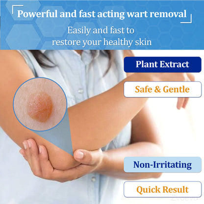 🔥 Zvoevo® BeeDerm RX Cream | Gentle Targeted Care for Warts, Skin Tags, Bumps, Infections, Cysts and Scars