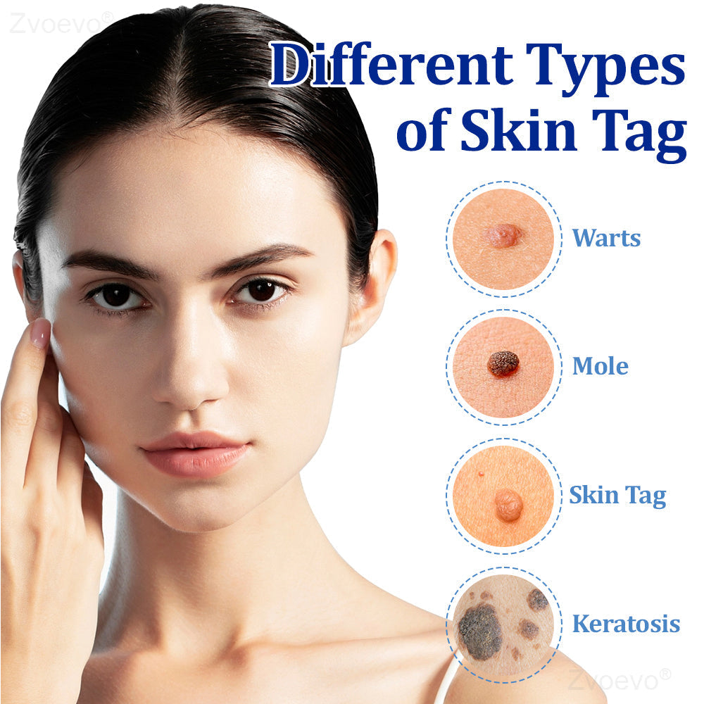 🔥 Zvoevo® BeeDerm RX Cream | Gentle Targeted Care for Warts, Skin Tags, Bumps, Infections, Cysts and Scars