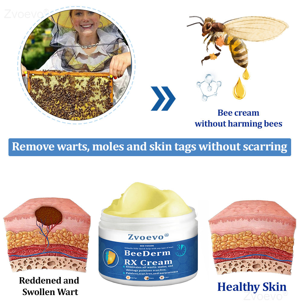 🔥 Zvoevo® BeeDerm RX Cream | Gentle Targeted Care for Warts, Skin Tags, Bumps, Infections, Cysts and Scars