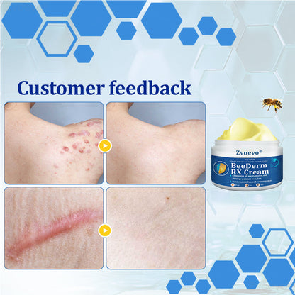 🔥 Zvoevo® BeeDerm RX Cream | Gentle Targeted Care for Warts, Skin Tags, Bumps, Infections, Cysts and Scars