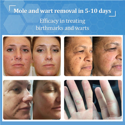🔥 Zvoevo® BeeDerm RX Cream | Gentle Targeted Care for Warts, Skin Tags, Bumps, Infections, Cysts and Scars