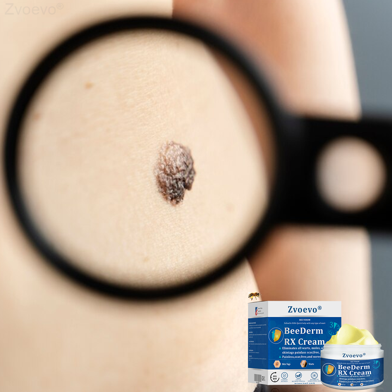 🔥 Zvoevo® BeeDerm RX Cream | Gentle Targeted Care for Warts, Skin Tags, Bumps, Infections, Cysts and Scars