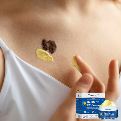 🔥 Zvoevo® BeeDerm RX Cream | Gentle Targeted Care for Warts, Skin Tags, Bumps, Infections, Cysts and Scars